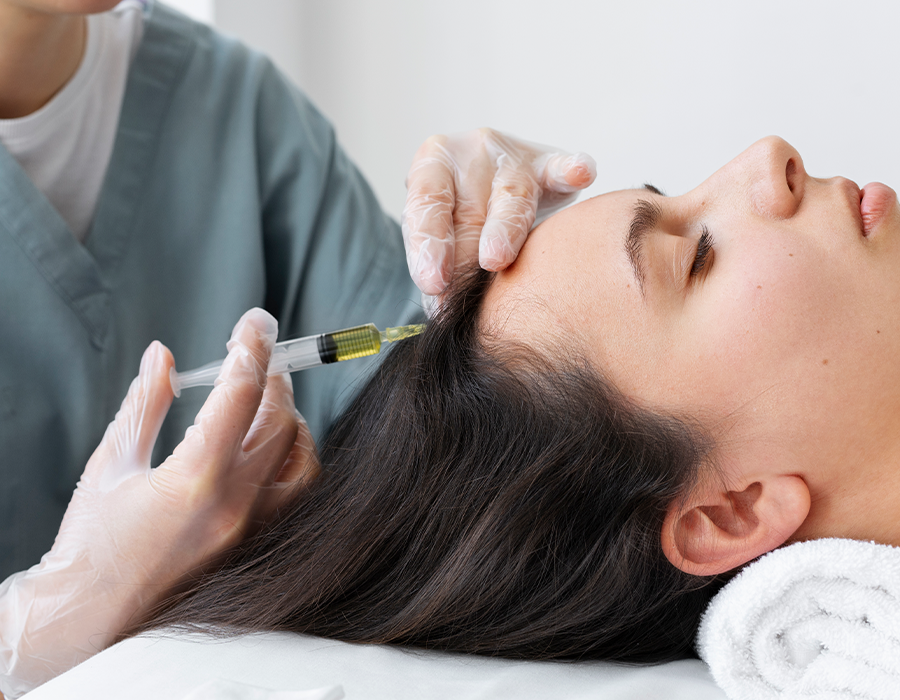 saç mezoterapisi